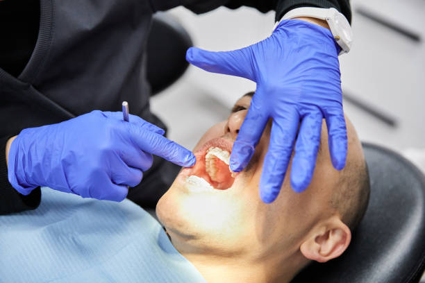 Best Emergency Dental Care for Abscessed Tooth in Vallejo, CA