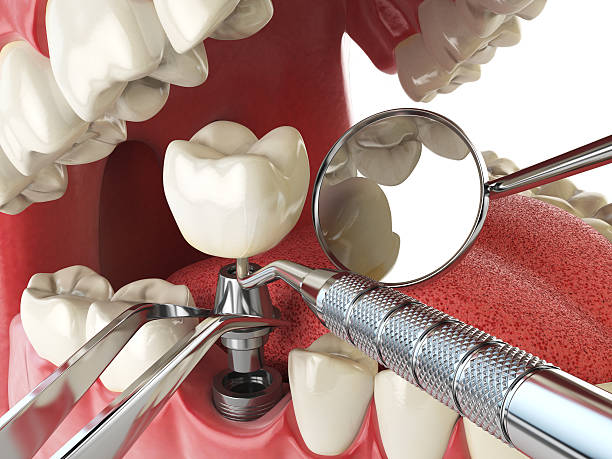 Best Emergency Cosmetic Dentistry in Vallejo, CA